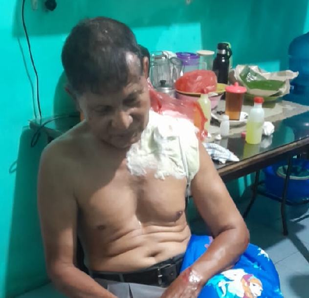 Loper Koran Jadi Korban Begal di Medan