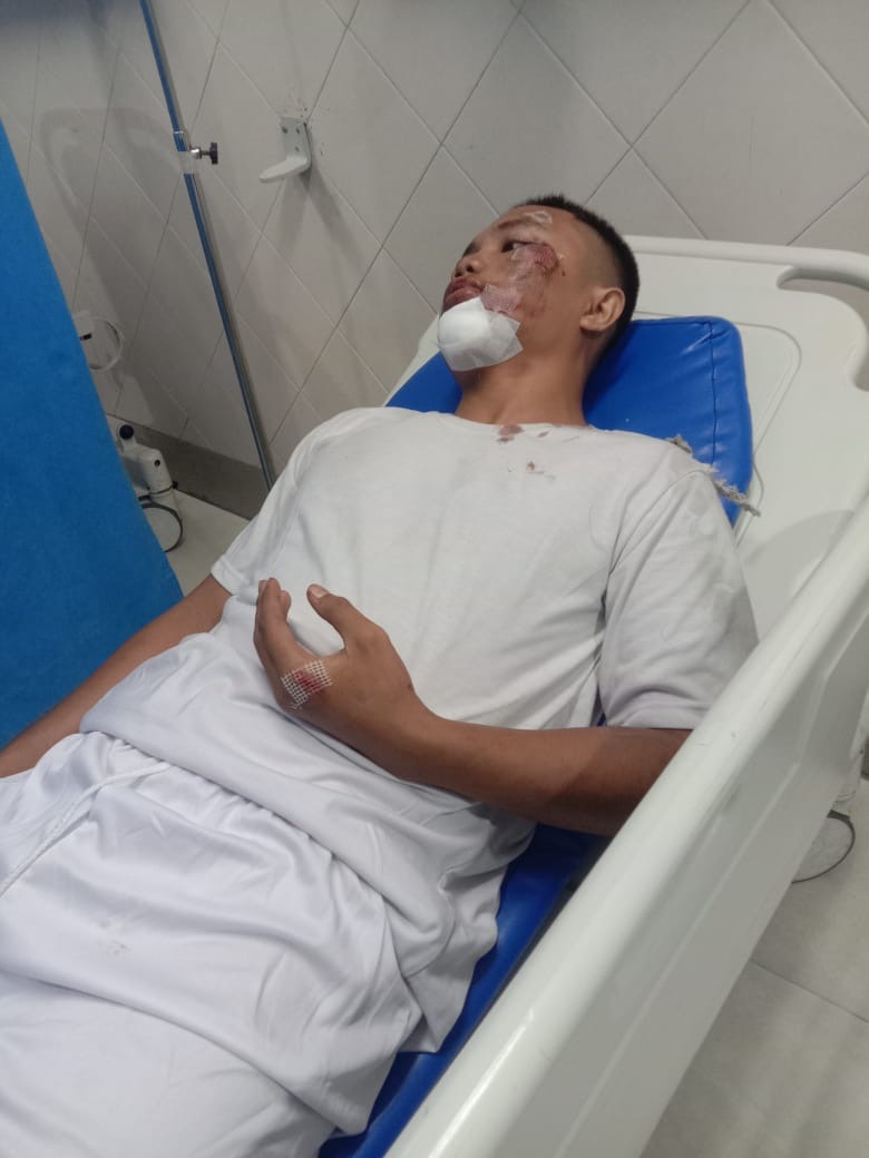 Casis Bintara Polri Dibegal di Jembatan Tembung